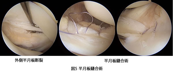 手術方法