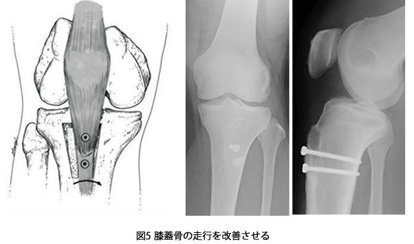 手術方法