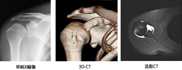 単純X線、3D-CT、造影CT