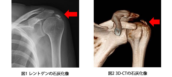 診断