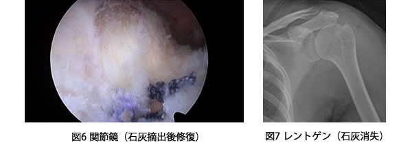 治療