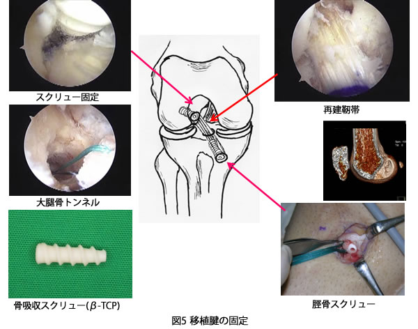 手術方法