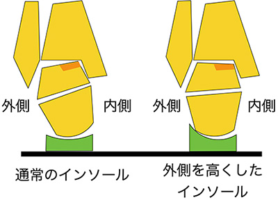 【画像】インソール